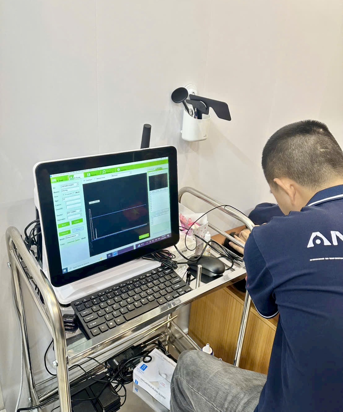Máy siêu âm mắt SAB-500