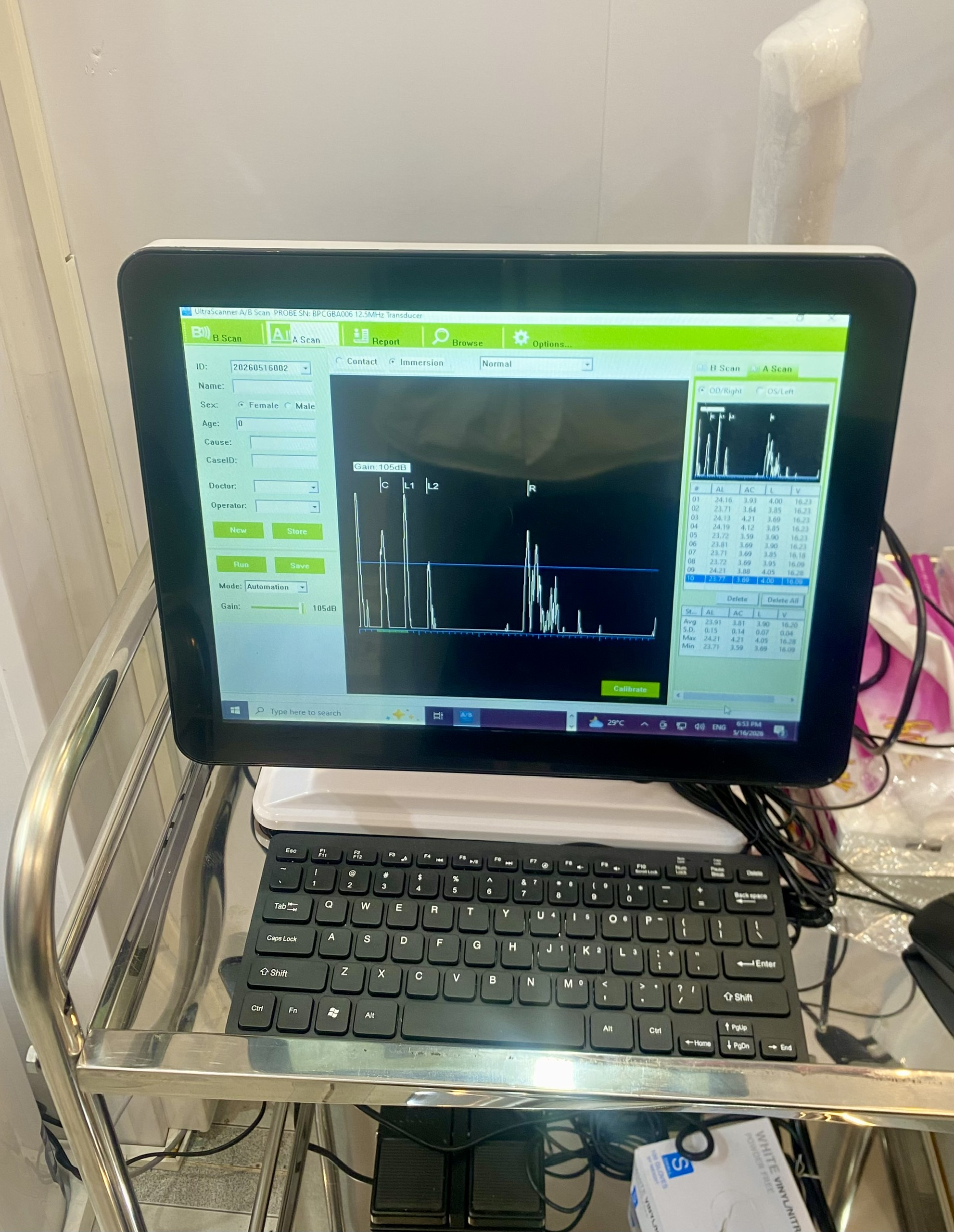 Máy siêu âm mắt SAB-500