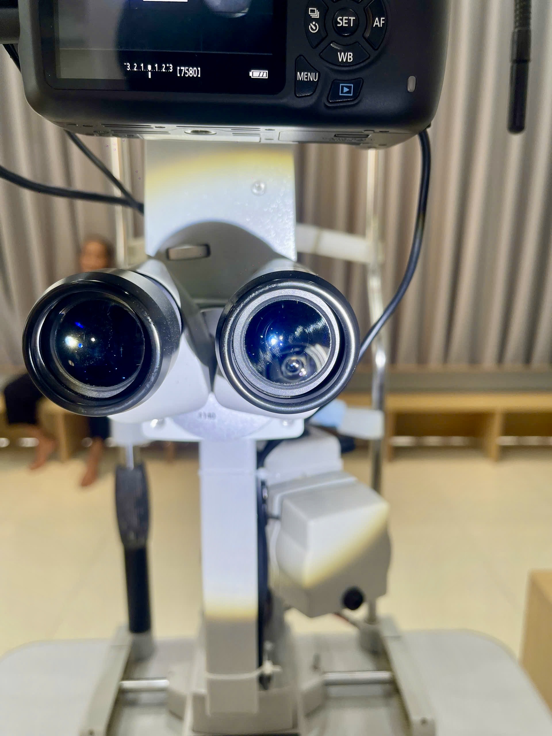 Sinh hiển vi khám mắt tích hợp camera