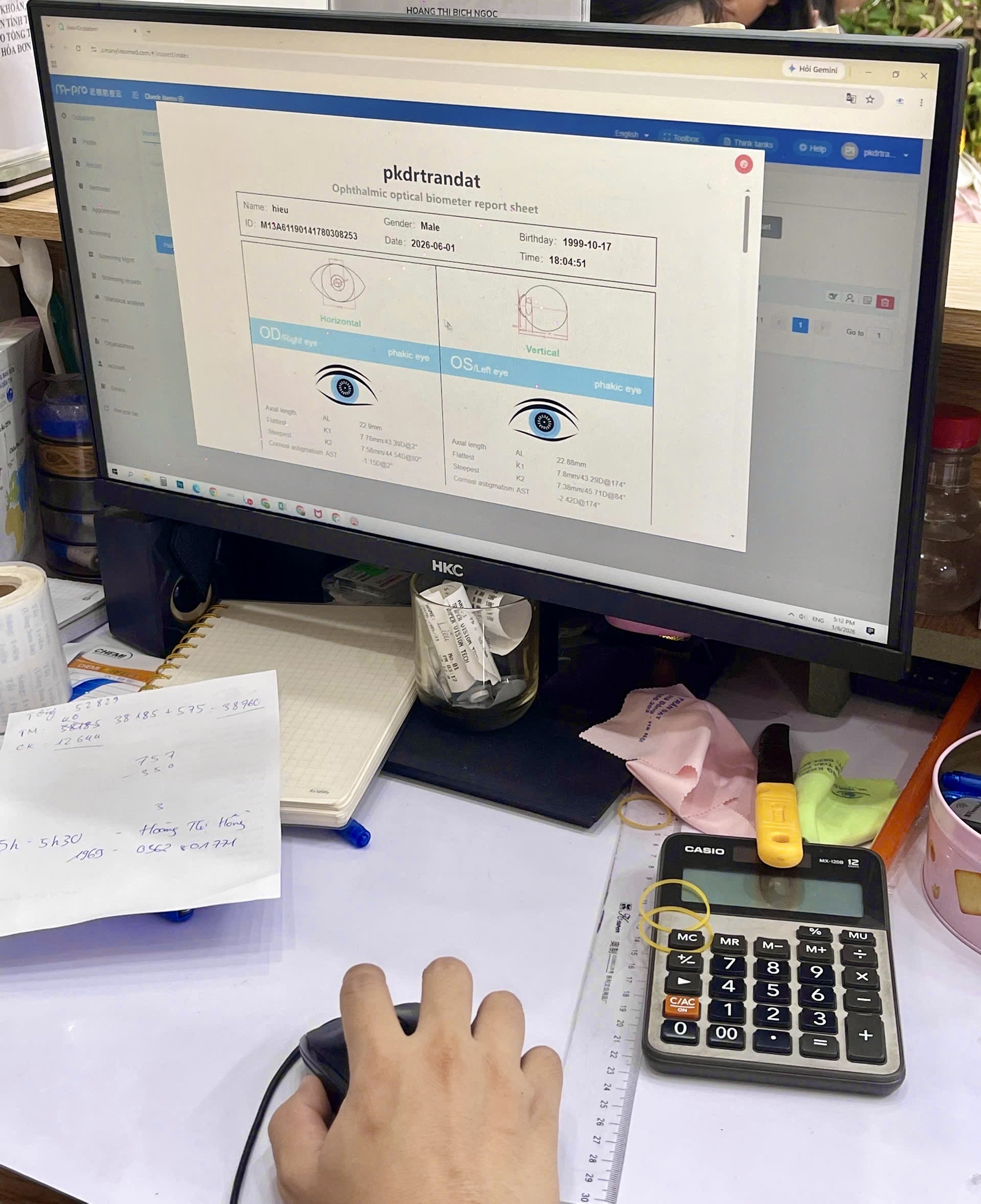 Sinh trắc học nhãn cầu Stareyes-1000P